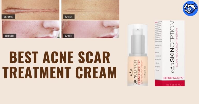 Best Acne Scar Treatment Cream 2021